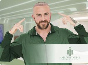 Natural hairline after a hair transplant at Hair of Istanbul