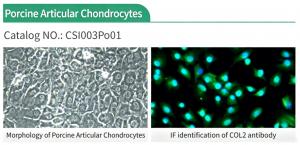 Knee disorders represent a major global public-health burden Figure 1. Morphology and COL2-based immunofluorescence identification of porcine articular chondrocytes (Cat.No. CSI003Po01)