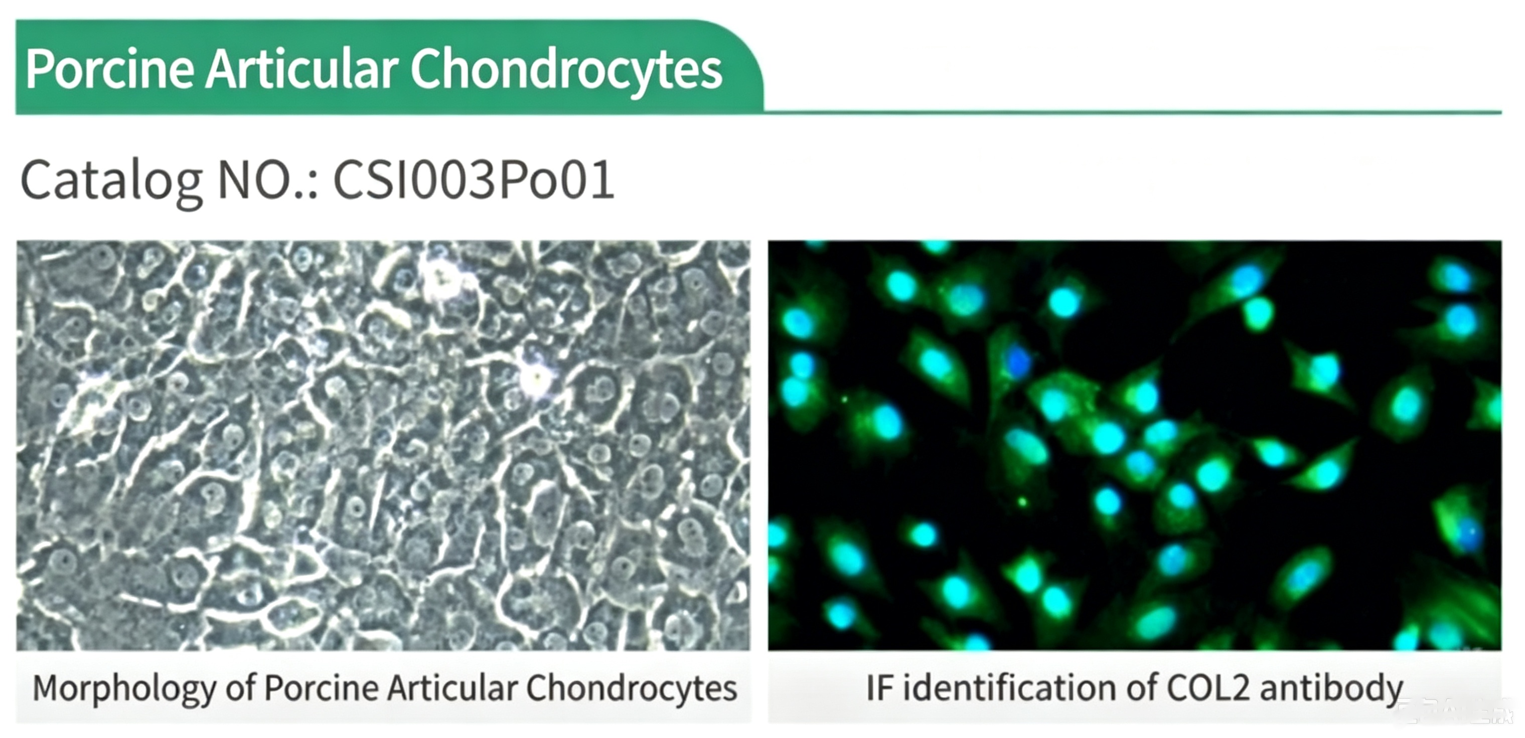 Four Core Joint‑Cell Panel: Cloud‑Clone’s Source‑QC Primary Cells Advance Precision Knee‑Disease Research