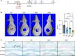 Bone Healing Is a Team Effort, Study Finds