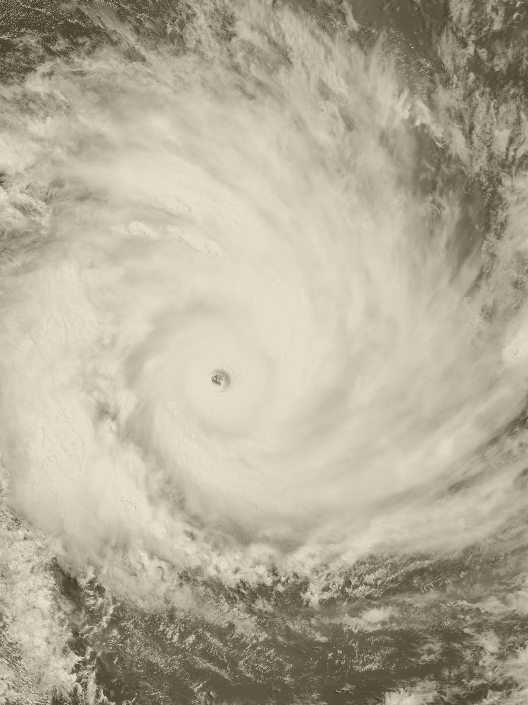 Orthopedic Injury Patterns and Prevention During Hurricane Preparedness