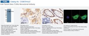 Figure 3 WB, IHC and IF application of Anti-Tubulin Beta (TUBb) Monoclonal Antibody (Product No.CAB870Hu22)
