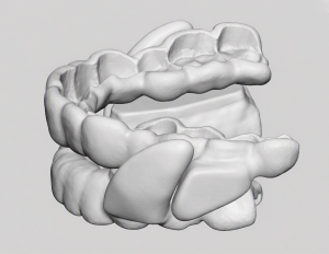 AIO Breathe for obstructive sleep apnea for children, teenagers and adults