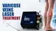Endovenous Laser Ablation: TRIANGEL's 1470nm Diode Laser for Varicose Vein and Venous Reflux Treatment