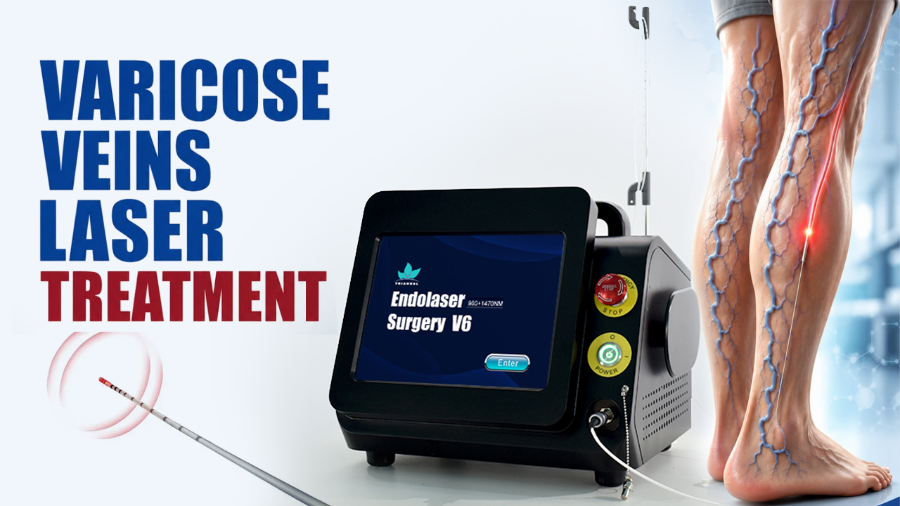 Endovenous Laser Ablation: TRIANGEL’s 1470nm Diode Laser for Varicose Vein and Venous Reflux Treatment