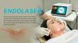 Triangel endolaser Masterclass: Hands-On Training on TRIANGEL's Endolaser for Skin Firming and Dermal Remodeling