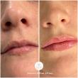 Realm Medical Arts Announces Expanded Aesthetic Services in Provo