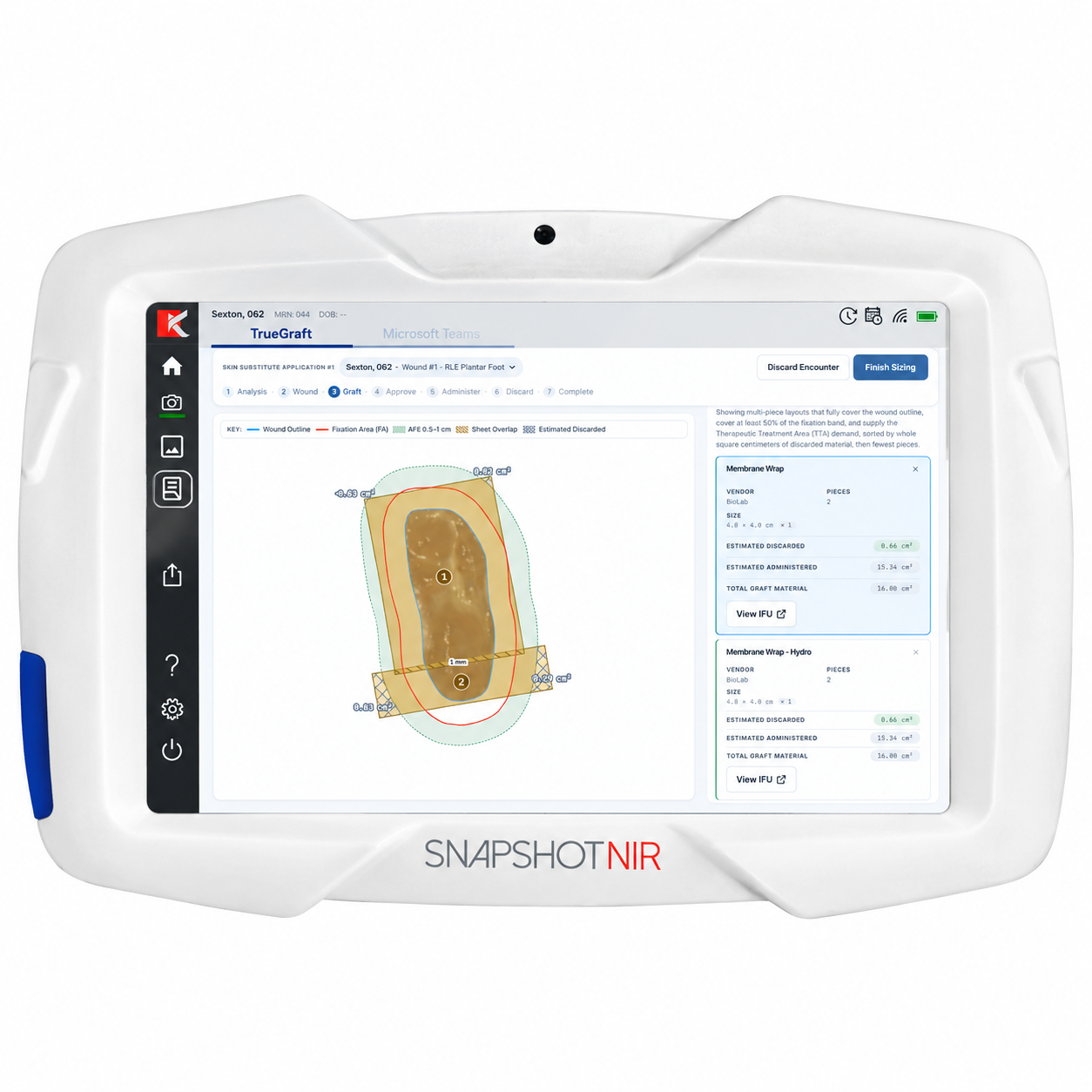 Kent Imaging Partners with TrueGraft to Integrate Precision Wound Sizing into the Snapshot Imaging Platform
