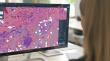 NGS macrodissection workflow available from Techcyte and Aignostics