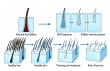 Dihydrotestosterone (DHT): Beyond Hair Loss — Key Regulator Across Multiple Disease Pathways