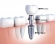 Parkview Dental Associates Sc Details: Family and Cosmetic Dental Services
