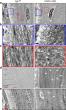 Faulty Bone Matrix May Explain Why Newly Formed Bone Cells Die