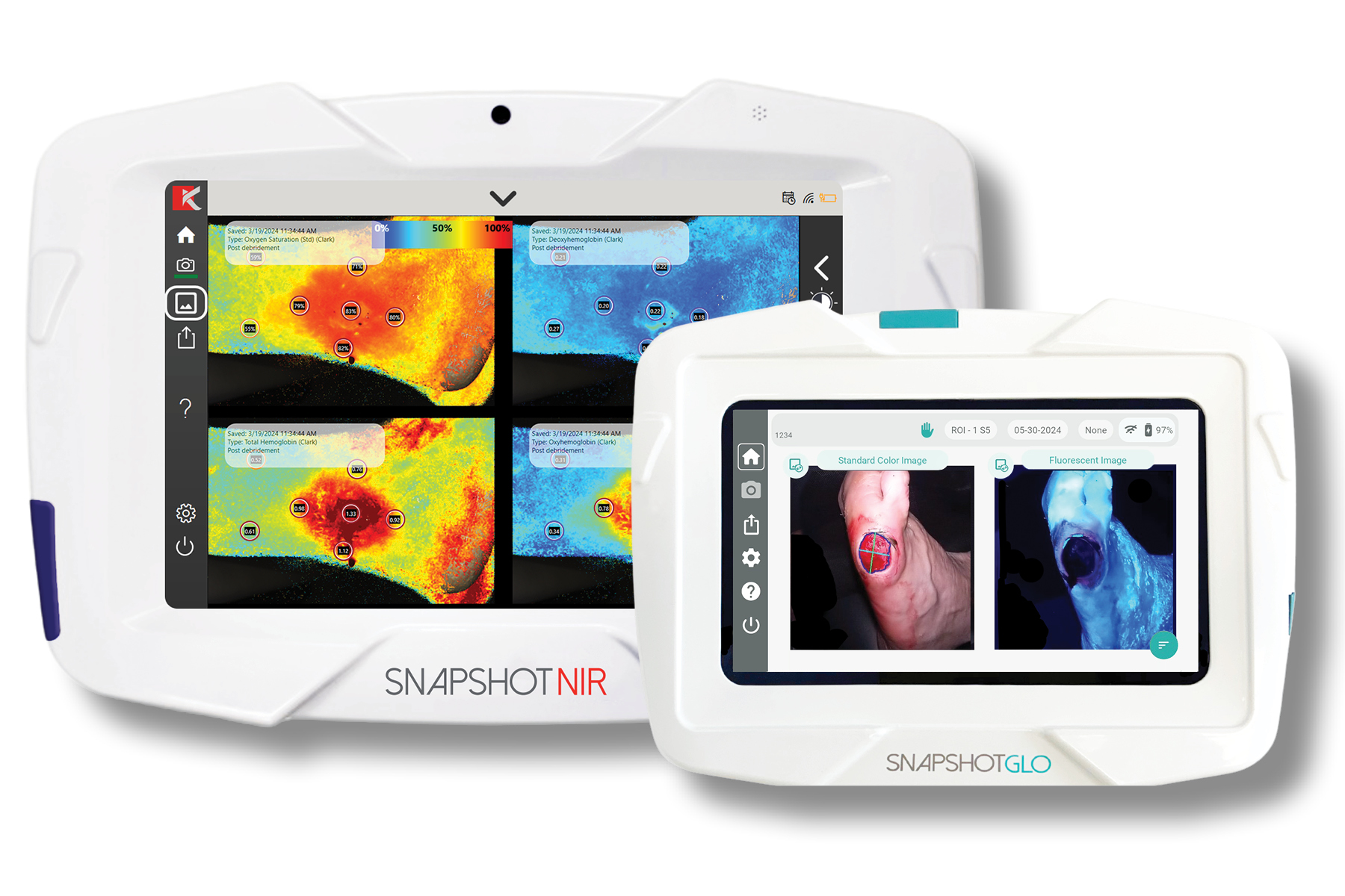 PRISM Clinical Algorithm for Chronic Wound Care Published; Imaging-First Framework Centered on Kent Imaging’s Platform
