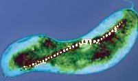 A chain of magnets in a simple bacterium, as also found in the human brain.