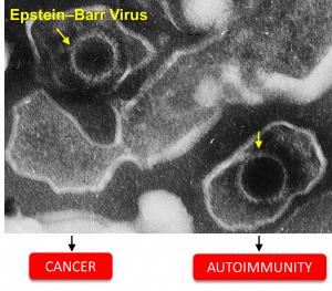 In a paper published on line today, scientists at InsideOutBio and the Higher School of Economics and Computer Science examine mechanisms underlying chronic persistence of Epstein-Barr Virus(EBV) in humans, sometimes referred to as long EBV Epstein-Barr virus, cancer, autoimmunity, Z-DNA, flipons