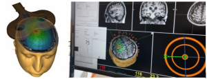 Consciousness Measurement