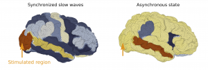 Brain Stimulation