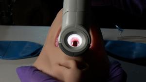 Glottic  view with Vie Scope