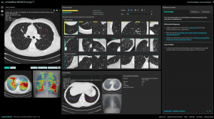 contextflow SEARCH Lung CT's user interface