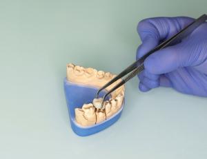 The €14.2 Billion European Dental Prosthetics Market Including CAD ...