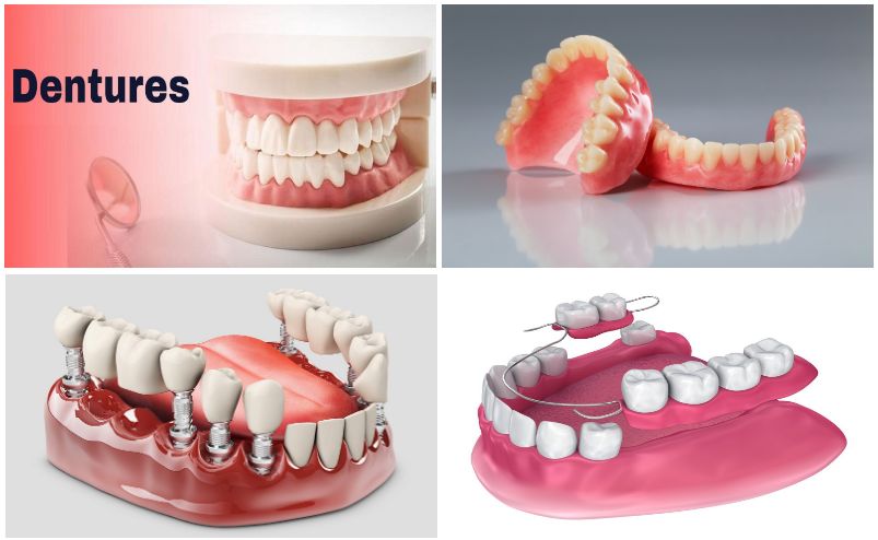 Dentures Market Future Business Opportunities 2022 2028 Dentsply   8336701 Dentures 803x494 