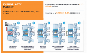 Kyphoplasty