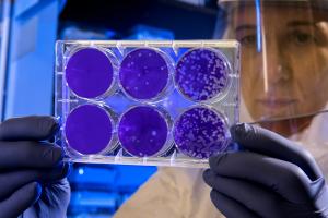 A picture of a medical researcher looking at Petri dishes full of bacteria, research funded by The Everest Foundation.