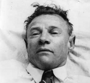 The Somerton Man Autopsy Photo