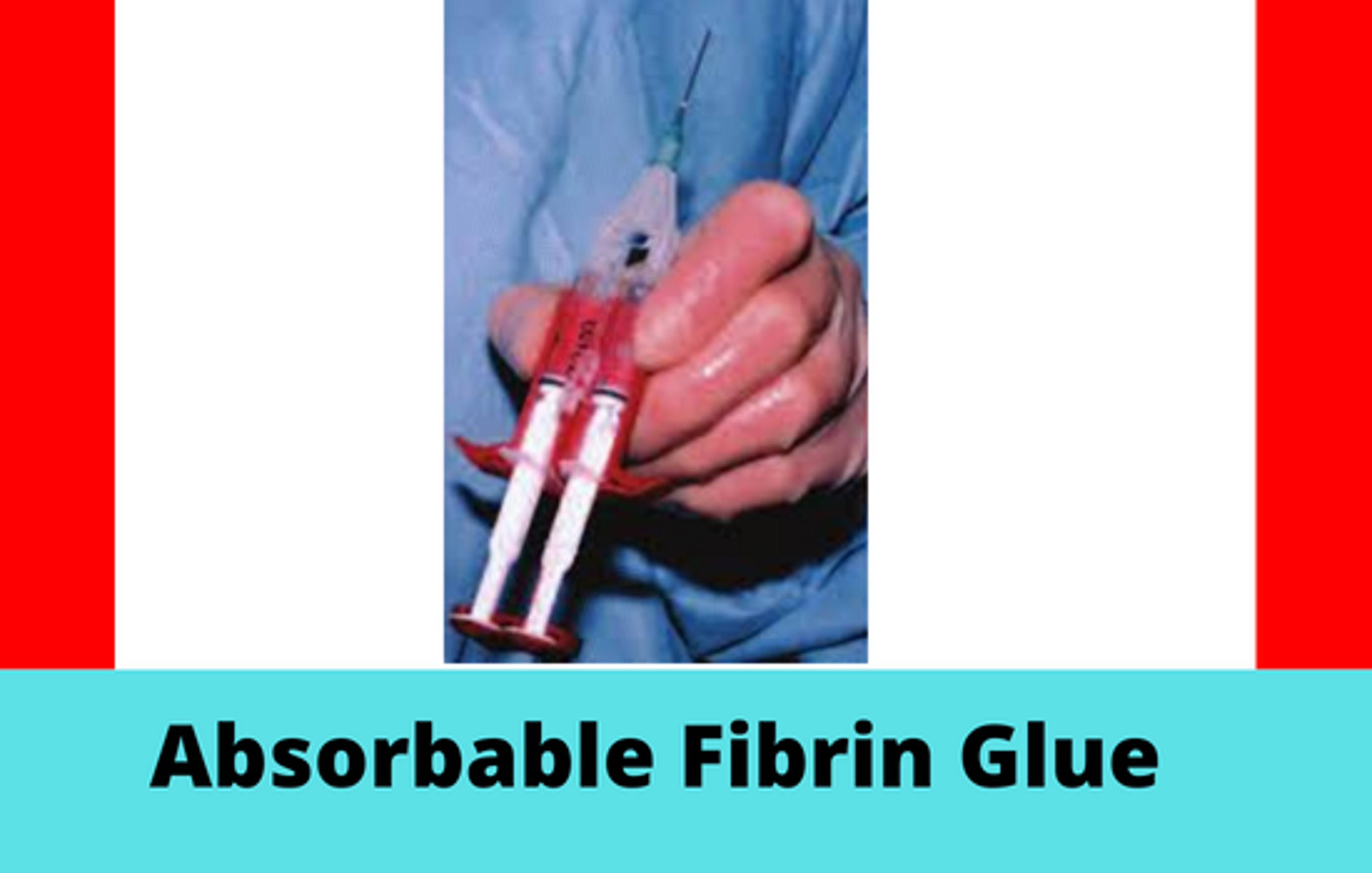 Global Absorbable Fibrin Glue Market Specifying Major Challenges and
